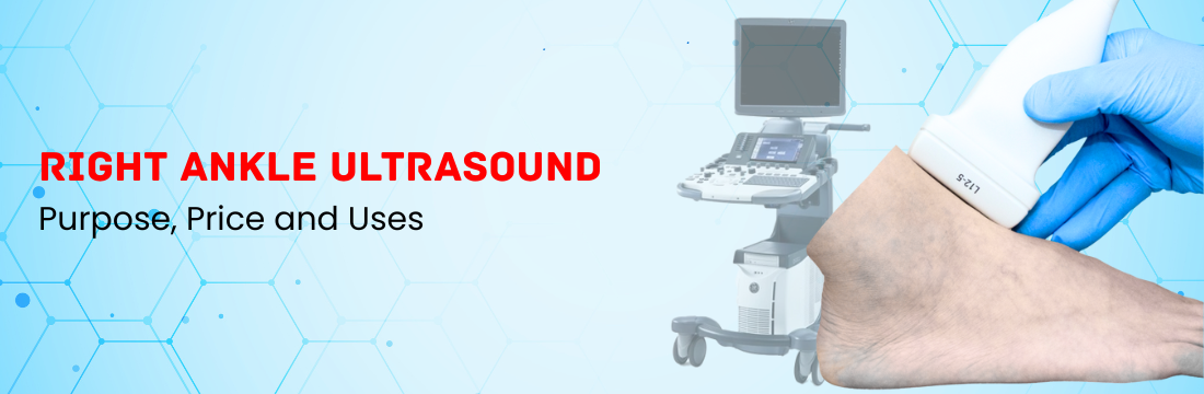 Right ankle Ultrasound: Purpose, Price and Uses
